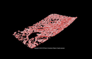 Human Choroid_OCTlab. Copyright © 2016 OCTlab University of Basel, Switzerland. All rights reserved.