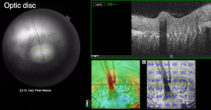 Optic disc vessels_Minipig. Copyright © 2016 OCTlab University of Basel. All rights reserved.